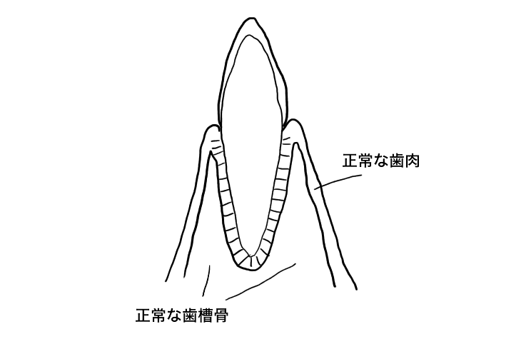 正常な歯